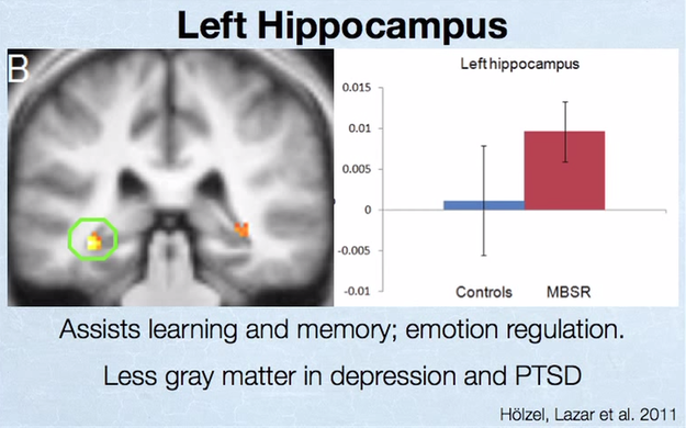 The same study also compared the brains of non-meditators to those who had just undergone an eight week meditation program, finding the same results.