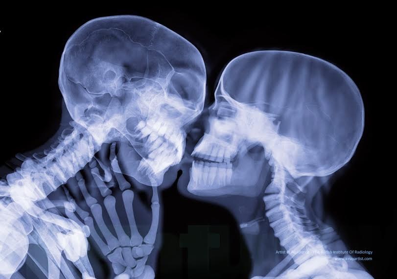 How romantic is kissing, really?