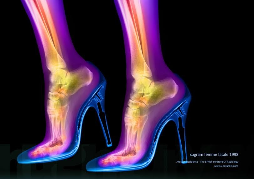 Yeah, yeah stilettos are STILL fashionable and somehow they'll never go out of style, but when you see how it distorts your foot then it's clear why those heels cause foot pain. Ouch.