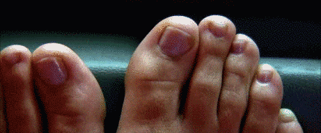 21 Things That Happen When You Have A Ridiculously Long Second Toe