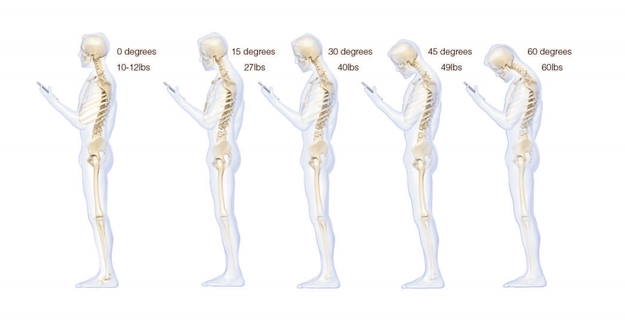 And finally, this is what your spine looks like if you were looking down at your phone while reading this post.